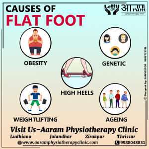 Causes of Flat Foot