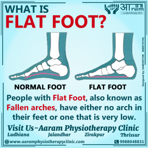 What is Flat Foot