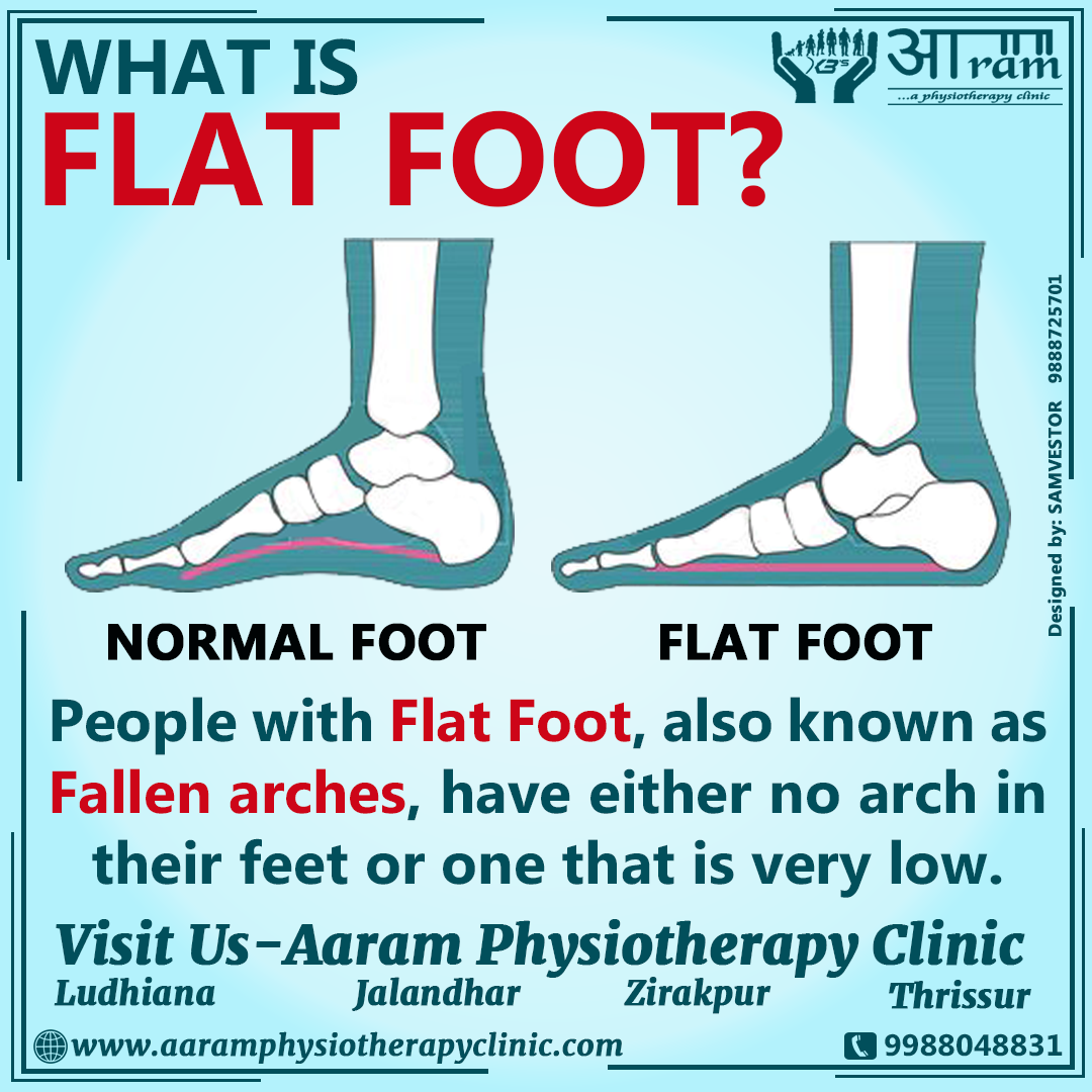 Flat meaning. Flat Footed. Плоскостопие. Flatfoot технология. Flat Footed meaning.